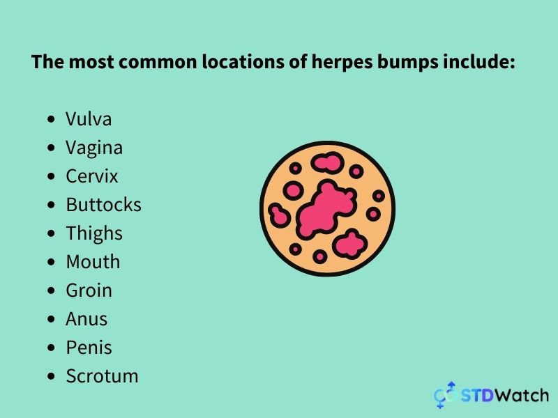 common-locations-for-herpes